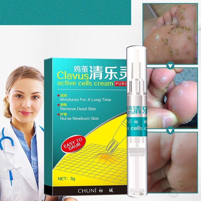 Universal Hand And Foot Calluses