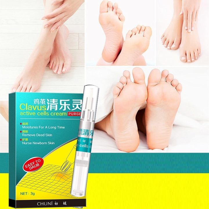 Universal Hand And Foot Calluses